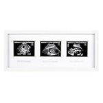 Sonogram Picture Frame – Gifts for 