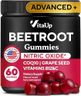 VitaUp Beet Root Gummies – Beet Gummies – Red Beets Supplements with Beetroot, Grape Seed, Coq10, Vitamin C & B12 – 60 Beet Chews