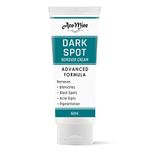 Age Spot Remover Creams