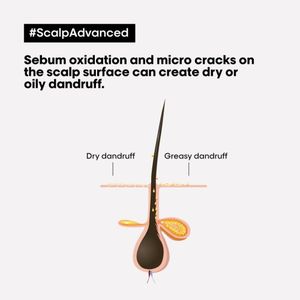 L'Oréal Scalp Advanced Anti-Dandruff Shampoo, 300ml