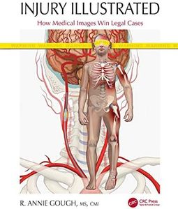 Injury Illustrated: How Medical Images Win Legal Cases