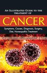 An Illustrated Guide to the Treatment of Cancer Symptoms, Causes, Diagnosis, Surgery, Diet, Homeopathic Treatment