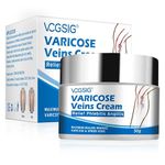 Treatment For Varicose Veins