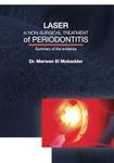 Laser in Non-Surgical Treatment of Periodontitis: Summary of the Evidence, Simply Explained