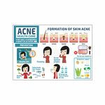 Anne Print Solutions® Formation of skin acne chart Posters For Hospital Posters | Nursing Home Posters | Clinic Posters Pack Of 1 Pcs Size 13 Inch X 19 Inch* Multicolor (APS6540)