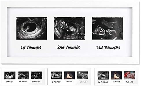 IHEIPYE Triple Sonogram Pregnancy Frame - Baby Ultrasound Picture Frame for Expecting Parents, Baby Shower Frame, Gender Reveal Party, Baby Nursery Decor, White