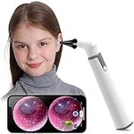 Wireless Otoscope Ear Camera with Dual View, 3.9mm 720PHD WiFi Ear Scope with 6 LED Lights for Kids and Adults, Compatible with Android and iPhone