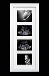 SignatureFrames.co.uk Pregnancy Ultrasound Sonogram Scan 1st Photo Hand Made 4 Aperture White Gloss Frame