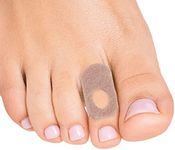 Steins Adhesive Felt Corn Pads, Corn Protector Cushion, Alleviates Shoe Friction & Pressure, W-7, 1/16", 500Count, Tan