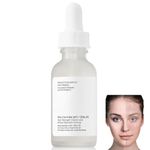 Niacinamide10%+Zinc 1%, Face moisturizer, Pore Reducer Face Serum,Tackles Blemishes, Niacinamide Serum for Blemish-Prone,Dull Skin,Softens, Balancing Sebum Production,Hydrating Serum (1)