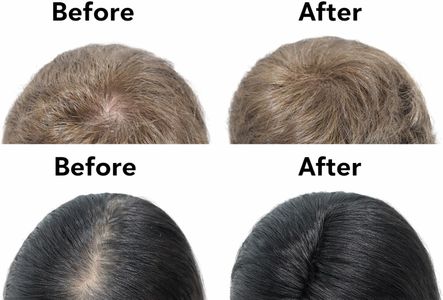 3D Hair Fibres Dark Brown 35g – Instant Hair Thickening Powder
