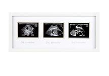 Pearhead Triple Sonogram Pregnancy Frame, Baby Scan Photo Frame, Pregnancy Announcement, White