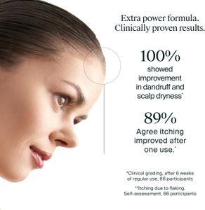 Neutrogena T/Gel Anti-Dandruff Shampoo 250ml – 3% Salicylic Acid, Scalp Relief