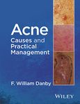 Acne: Causes and Practical Management